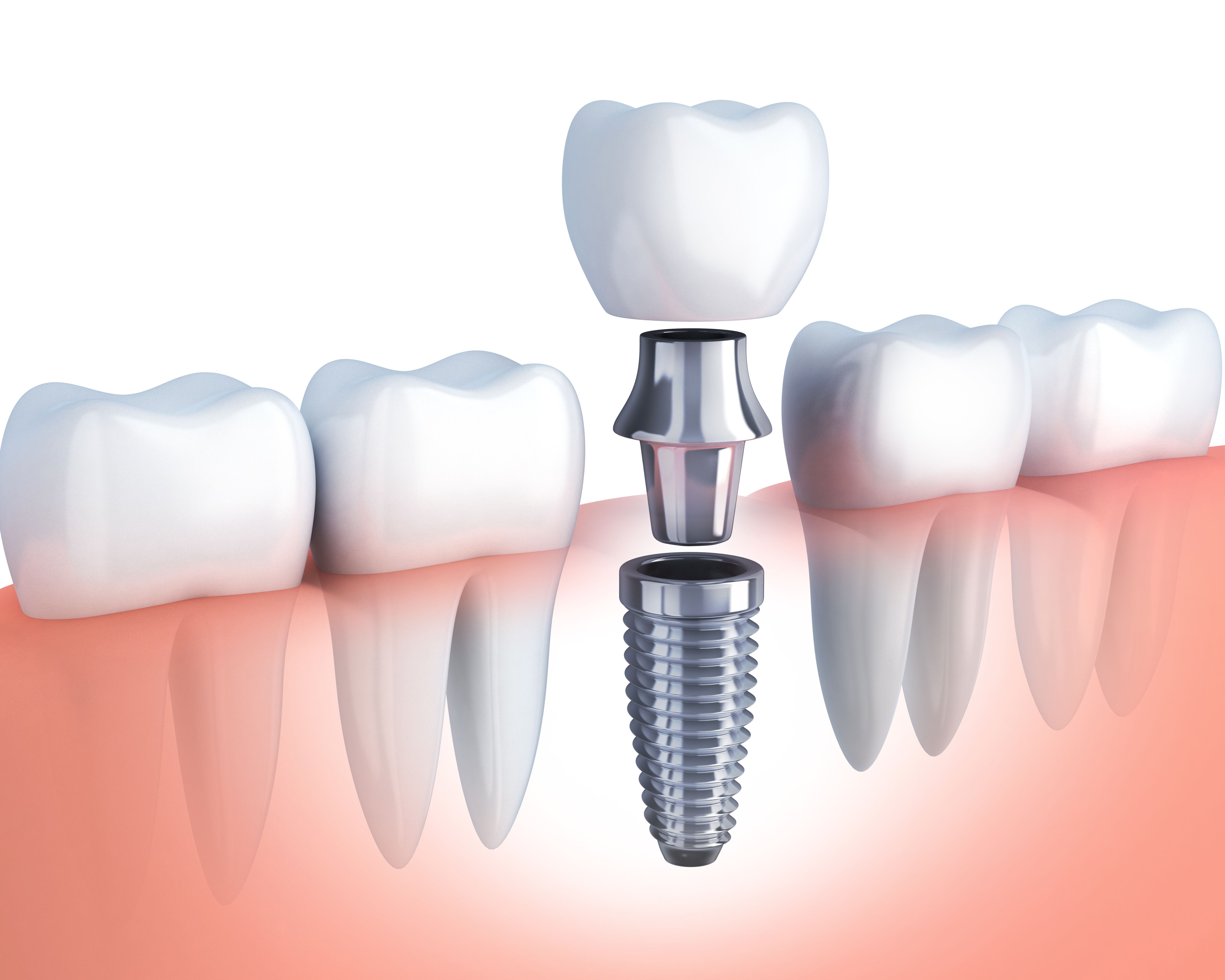 DIVINE SUPER  SPECIALITY DENTAL CLINIC PATTIKKAD